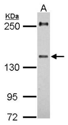 Western Blot: URB2 Antibody [NBP2-20817]