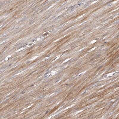 Immunohistochemistry-Paraffin: URG4 Antibody [NBP1-87983]