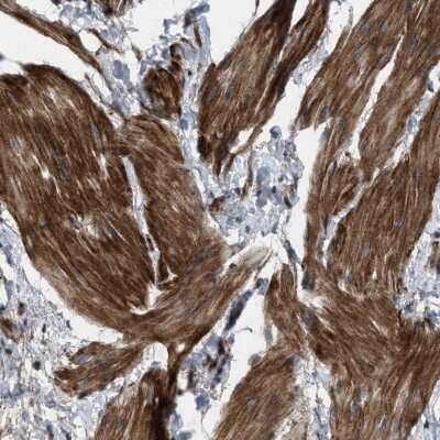 Immunohistochemistry-Paraffin: URG4 Antibody [NBP1-87984]