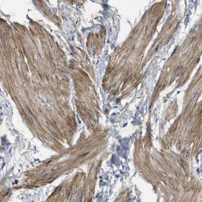 Immunohistochemistry-Paraffin: URG4 Antibody [NBP1-87985]