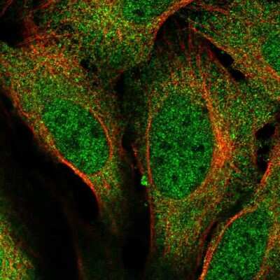 Immunocytochemistry/ Immunofluorescence: URI Antibody [NBP2-57701]