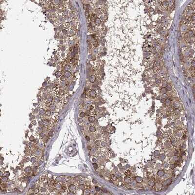Immunohistochemistry-Paraffin: URI Antibody [NBP2-57701]