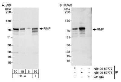 Western Blot: URI Antibody [NB100-59777]