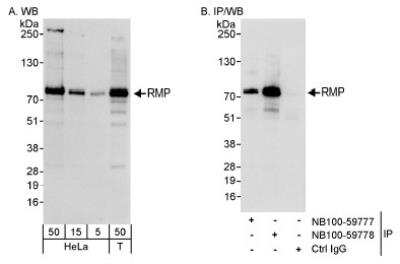 Western Blot: URI Antibody [NB100-59778]