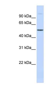 Western Blot: URI Antibody [NBP1-79413]