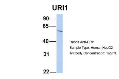 Western Blot: URI Antibody [NBP1-79413]