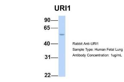Western Blot: URI Antibody [NBP1-79413]