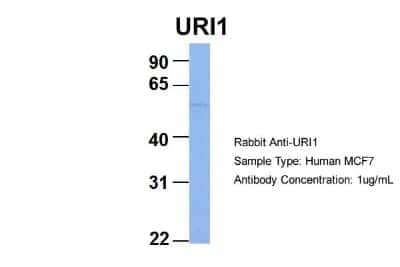 Western Blot: URI Antibody [NBP1-79413]