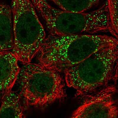 Immunocytochemistry/ Immunofluorescence: URM1 Antibody [NBP2-58447]