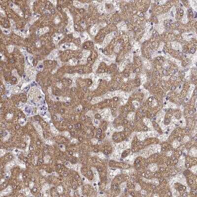 Immunohistochemistry-Paraffin: UROC1 Antibody [NBP2-62665]