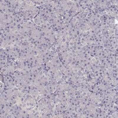 Immunohistochemistry-Paraffin: UROC1 Antibody [NBP2-62665]
