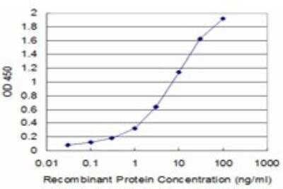 ELISA: UROD Antibody (2F5) [H00007389-M08]