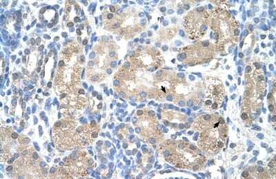 Immunohistochemistry-Paraffin: UROD Antibody [NBP1-56662]