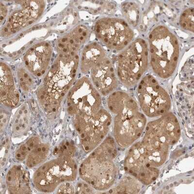 Immunohistochemistry-Paraffin: UROD Antibody [NBP1-89513]