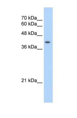 Western Blot: UROD Antibody [NBP1-56662]