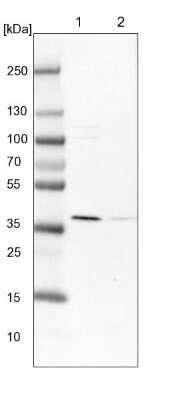 Western Blot: UROD Antibody [NBP1-85946]