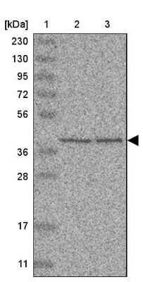 Western Blot: UROD Antibody [NBP1-89513]