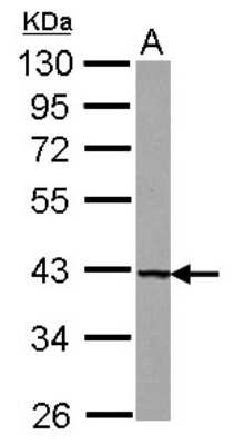 Western Blot: UROD Antibody [NBP2-20818]