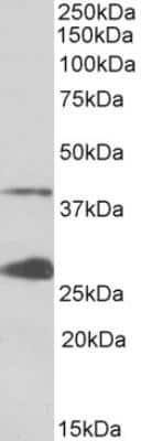 Western Blot: UROD Antibody [NBP2-26190]