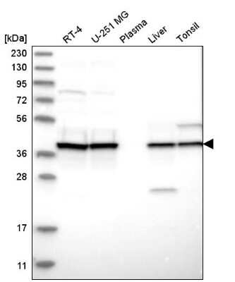 Western Blot: UROD Antibody [NBP2-57511]