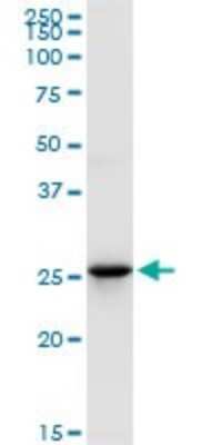 Western Blot: UROS Antibody [H00007390-D01P]