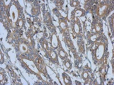 Immunohistochemistry-Paraffin: FERMT3/URP2 Antibody [NBP2-20821]