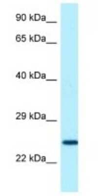 Western Blot: USAG1/SOSTDC1 Antibody [NBP1-98525]