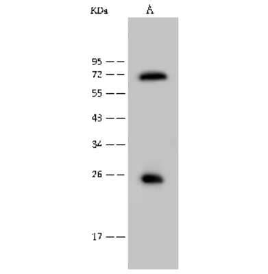 Western Blot: USAG1/SOSTDC1 Antibody [NBP2-99425]