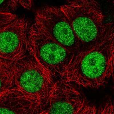 Immunocytochemistry/ Immunofluorescence: USF1 Antibody [NBP2-38290]