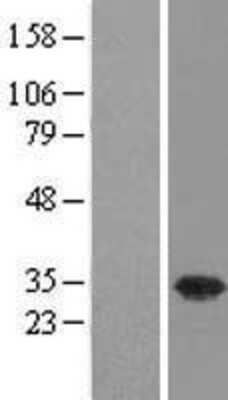 Western Blot: USF1 Overexpression Lysate [NBL1-17637]