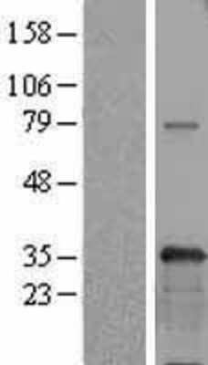 Western Blot: USF1 Overexpression Lysate [NBL1-17638]