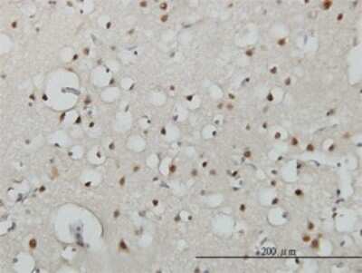 Immunohistochemistry-Paraffin: USF2 Antibody (5E9) [H00007392-M01]