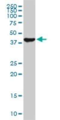 Western Blot: USF2 Antibody (5E9) [H00007392-M01]