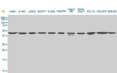 Western Blot: USF2 Antibody (5F2) [H00007392-M02]