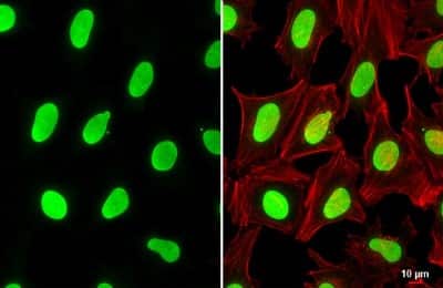 Immunocytochemistry/ Immunofluorescence: USF2 Antibody [NBP3-12887]