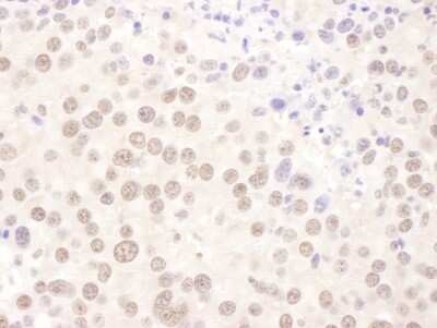 Immunohistochemistry: USF2 Antibody [NBP1-92647]