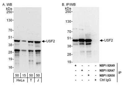 Immunoprecipitation: USF2 Antibody [NBP1-92650]
