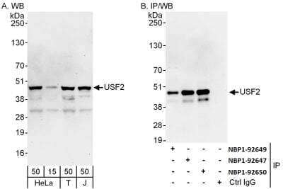 Western Blot: USF2 Antibody [NBP1-92649]