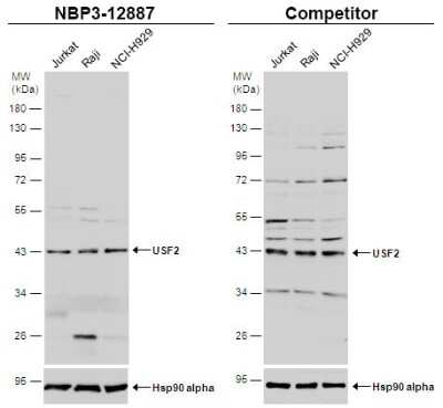 Western Blot: USF2 Antibody [NBP3-12887]