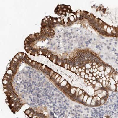 Immunohistochemistry-Paraffin: USH1C Antibody [NBP1-89189]