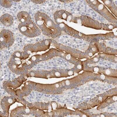 Immunohistochemistry-Paraffin: USH1C Antibody [NBP1-89189]