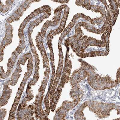 Immunohistochemistry-Paraffin: USH1C Antibody [NBP1-89189]