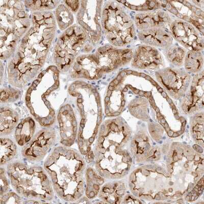 Immunohistochemistry-Paraffin: USH1C Antibody [NBP1-89189]