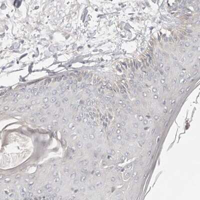 Immunohistochemistry-Paraffin: USH1C Antibody [NBP1-89189]