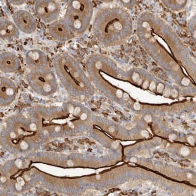 Immunohistochemistry-Paraffin: USH1C Antibody [NBP1-89190]