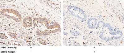 Immunohistochemistry-Paraffin: USH1C Antibody [NBP2-99408]