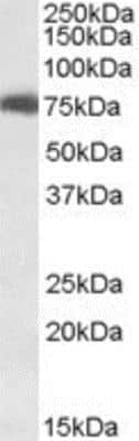 Western Blot: USH1C Antibody [NB100-1405]