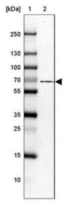 Western Blot: USH1C Antibody [NBP1-89191]