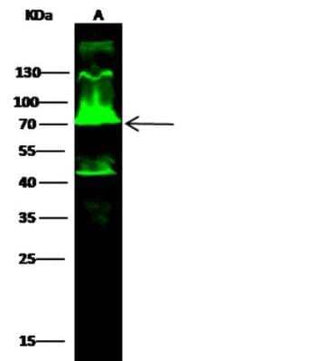 Western Blot: USH1C Antibody [NBP2-99408]