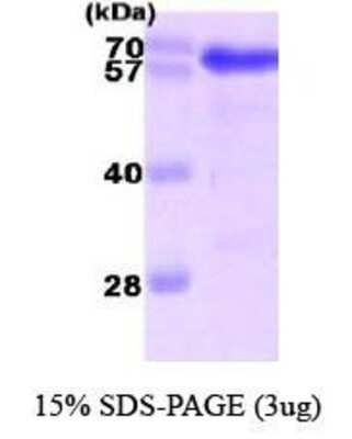 SDS-PAGE: Recombinant Human USH1C His Protein [NBC1-28773]